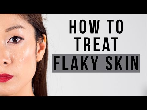 How to Treat Flaky Skin | Tips + Products | Viestelook - YouTube