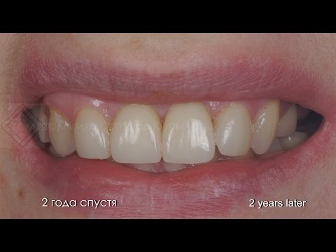 Картинки с 8 марта - Мир Позитива Как сделать временную татуировку