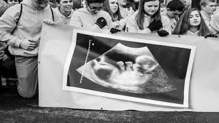 HOT NEWS | Opinion The Abortion Wars Have Become a Fight Over Science The New York Times
