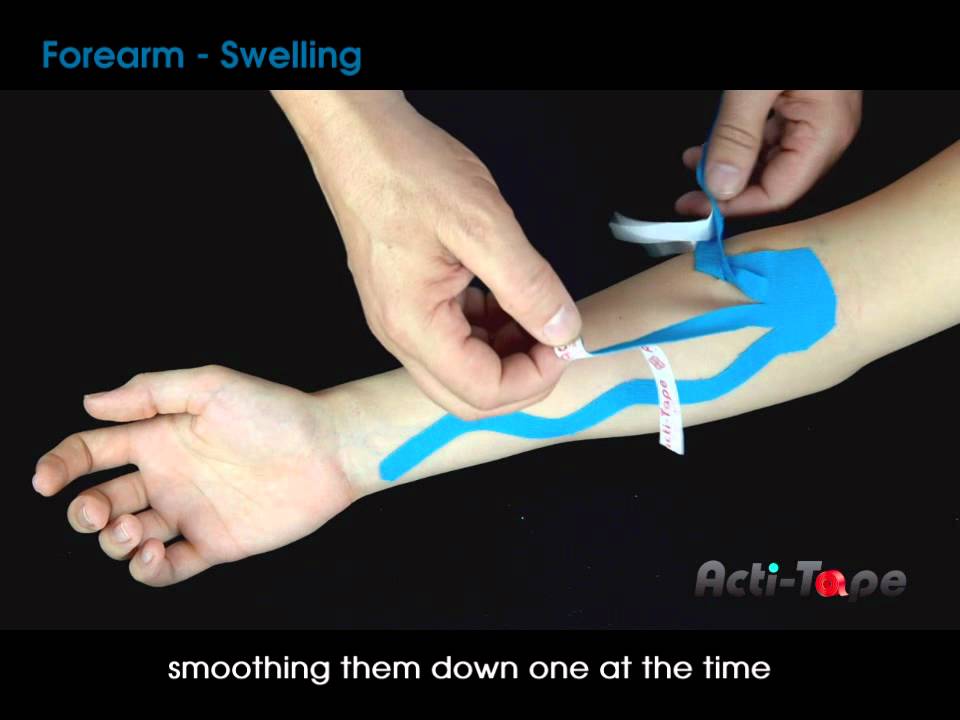 Acti-Tape - Forearm - Swelling - YouTube