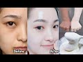 Japanese secret to whitening skin and get rid of pigmentation to get a fresh complexion