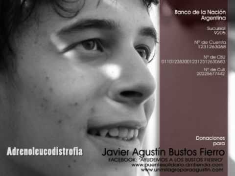 Un milagro para agustin