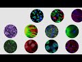 World's First Human Embryonic Stem Cell Trial for Spinal Cord Injury: Kate Sharify's Story