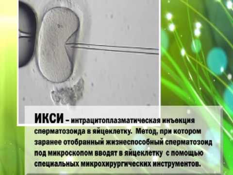 Спермограмма в тюмени малыш Спермограмма в тюмени малыш