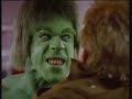 The incredible hulk meets daredevil heroes and villains