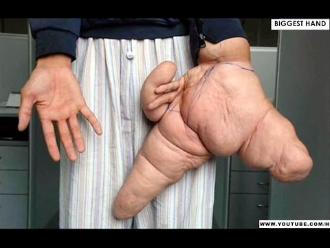 World's BIGGEST Human Body Parts - HD - YouTube
