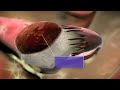 endometrium