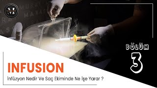 İnfüzyon Ünitesi Nedir? Saç Ekiminde İnfüzyon Ünitesi Ne İşe Yarar?