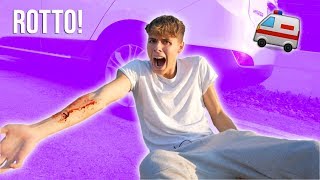 MI SONO ROTTO IL BRACCIO CADENDO DA UNA MACCHINA IN CORSA!! *sono andato in ospedale*