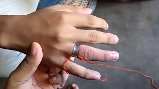How To Remove Ring From Swollen Finger || Ring Removal Swollen Finger