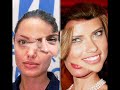 فضائح فنانات بدون مكياج