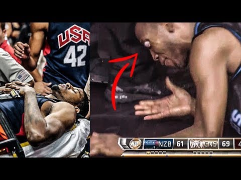 The Worst Basketball INJURI3S of All Time