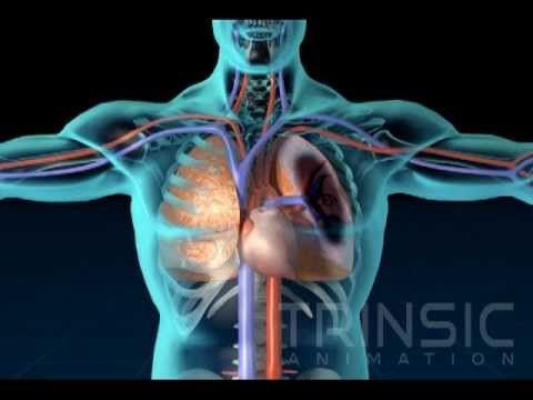 Pulmonary Embolism Medical Animation - YouTube