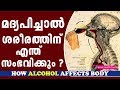 What Happens when you drink Alcohol | How Alcohol Affects Body | മദ്യപാനം| Ethnic Health Court