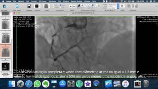 Interpretação prática da cineangiocoronariografia para a cirurgia de ponte de safena.