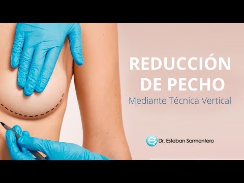 Radical breast reduction