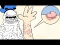 What Happens If You're Allergic To Water? | Dolan Life Myster...