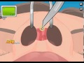 Nose Surgery Walkthrough [Specialist]