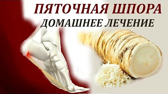 Пяточная шпора лечение в домашних условиях медикаментозно
