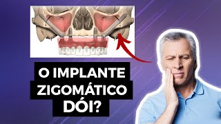 O Implante Zigomático Dói?