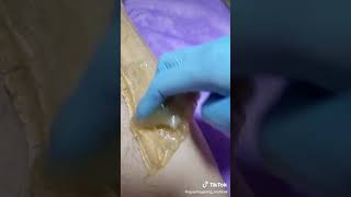 Aşırı Rahatlatıcı Ağda Videosu
