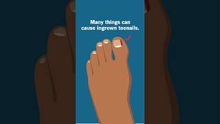 Thick toenails remedy. Let me show you how to restore your nails