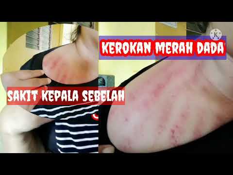 KEROKAN DADA DEPAN MERAH MERON~ READ CHEST SCRAPING