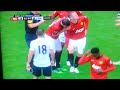 Rooney gets a massive gash and gets stitches [HD]