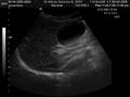 Ascariasis - Reservoirsource Ascariasis - Reservoirsource