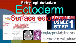 Embryologic Derivatives - Ectoderm- Surface Ectoderm, Craniopharyngioma In Hindiurdu By First Aid