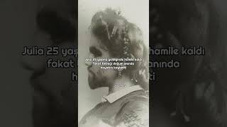 Yaşadığı Genetik Sorunlarla Boğuşan Julia Pastrananın Üzücü Hayat Hikayesi.