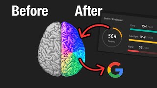 My Brain after 569 Leetcode Problems
