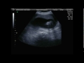 Baby Ultrasound 1