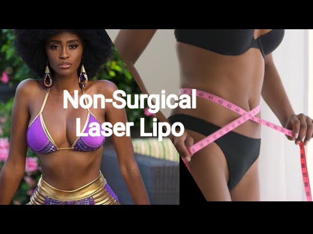 Laser Lipo in Kingston Jamaica Before & After, 2 inch loss instantly