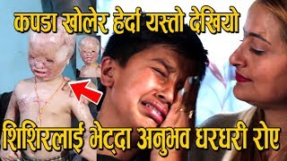 तेलमा डुबेका शिशिरलाई भेट्दा अनुभव रेग्मी धुरुधुरु रोए ! पुरै कपडा खोेल्दा यस्तो देखियो