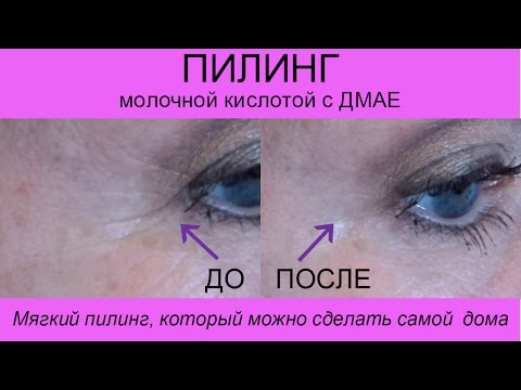 Поднимающаяся кровать своими руками