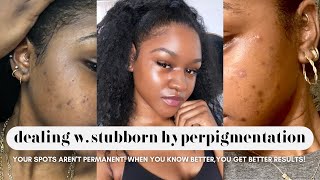 FADE STUBBORN HYPERPIGMENTATION | 7 Steps & Products for Better Results