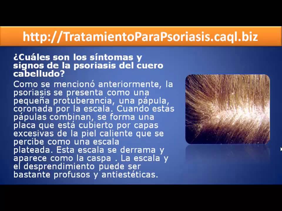 De que sale la psoriasis y como de curarle