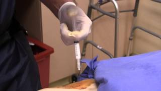 Lumbar epidural steroid injections for low back pain and sciatica side effects