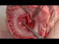 Anatomy
