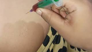 Im Injection Vlog