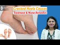 10 Home Remedies for CRACKED HEELS | Magical Cracked Heel Remedies-Dr. Amee Daxini | Doctors' Circle