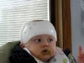 benign paroxysmal tonic upgaze disorder
