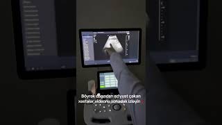 Diqqətlə Qulaq Asın,Vacib Məlumatdır,
