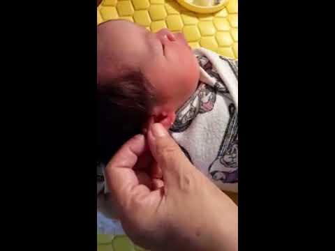 VIDEO : bayi baru lahir langsung di tindik -  ...
