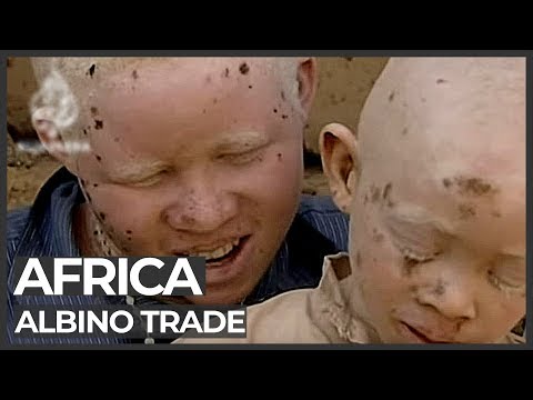 African albinos killed for body organs - 23 Jul 09