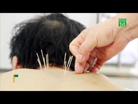 Châm cứu để chữa đau vai gáy, người đàn ông bị áp xe cổ | VTC14