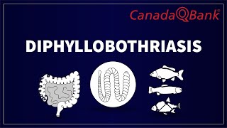 Diphyllobothriasis Explained Infections, Symptoms, Diagnosis & Treatment Canadaqbank