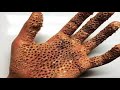 Kesinlikle Her İnsanda Bulunan 5 FOBİ ( TRİPOFOBİ )