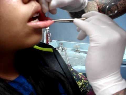 spider bites piercing images. spider bites piercing. spider bites piercing images.